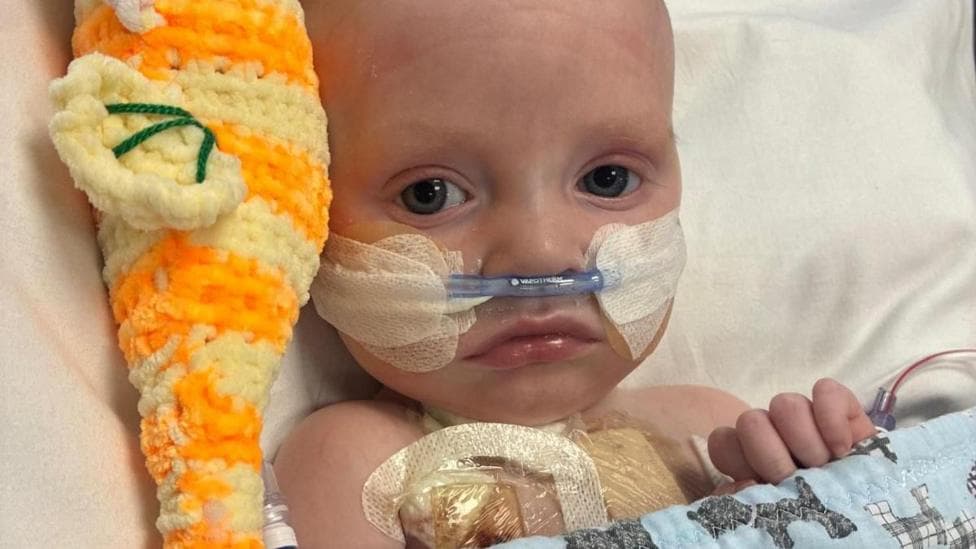 Macs Green is a small baby. He is lying in a hospital bed with a tube coming from his nose. He has an orange cuddly toy on his right