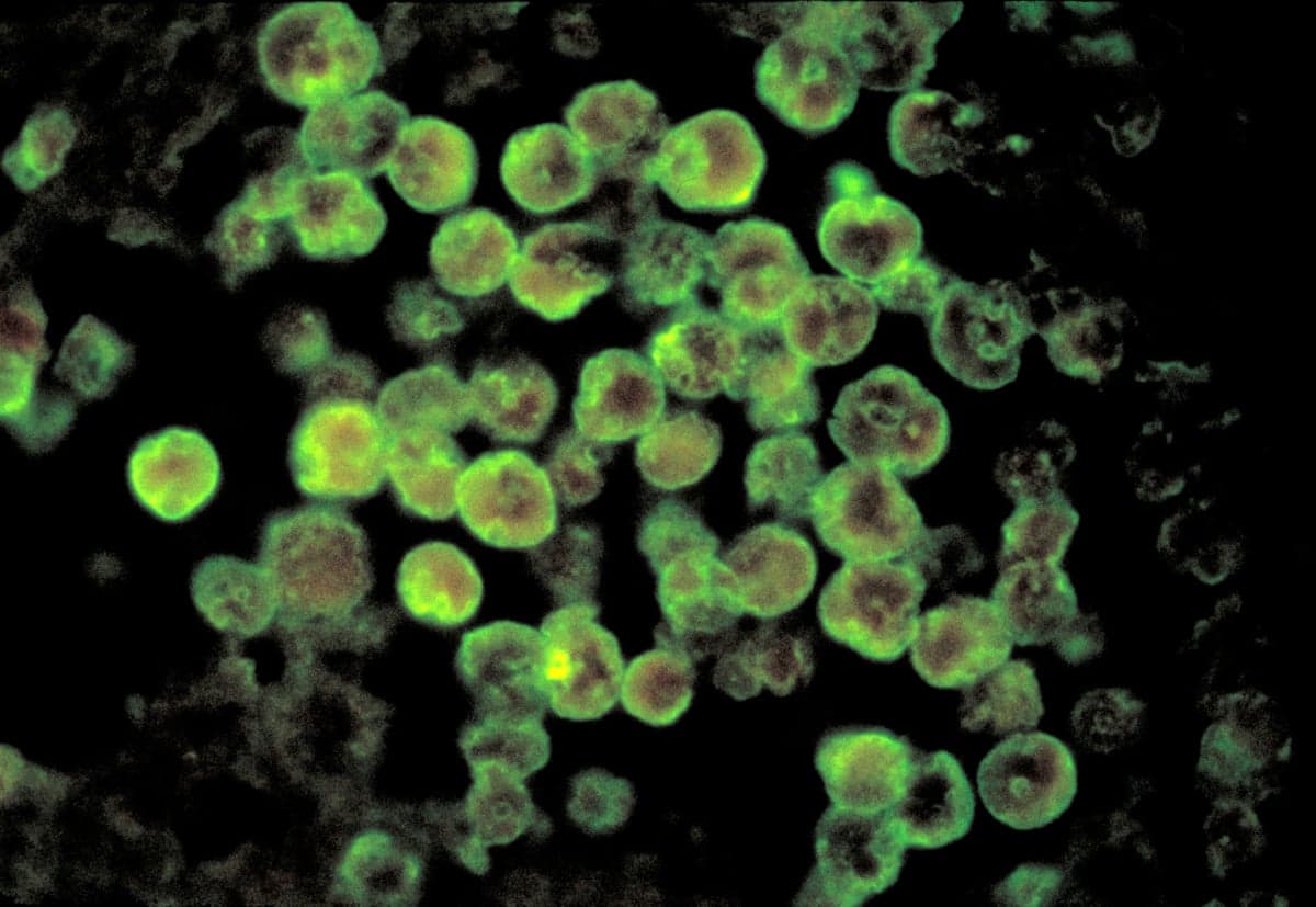 Microscopic image of Naegleria fowleri amoeba cells glowing green under fluorescent staining.