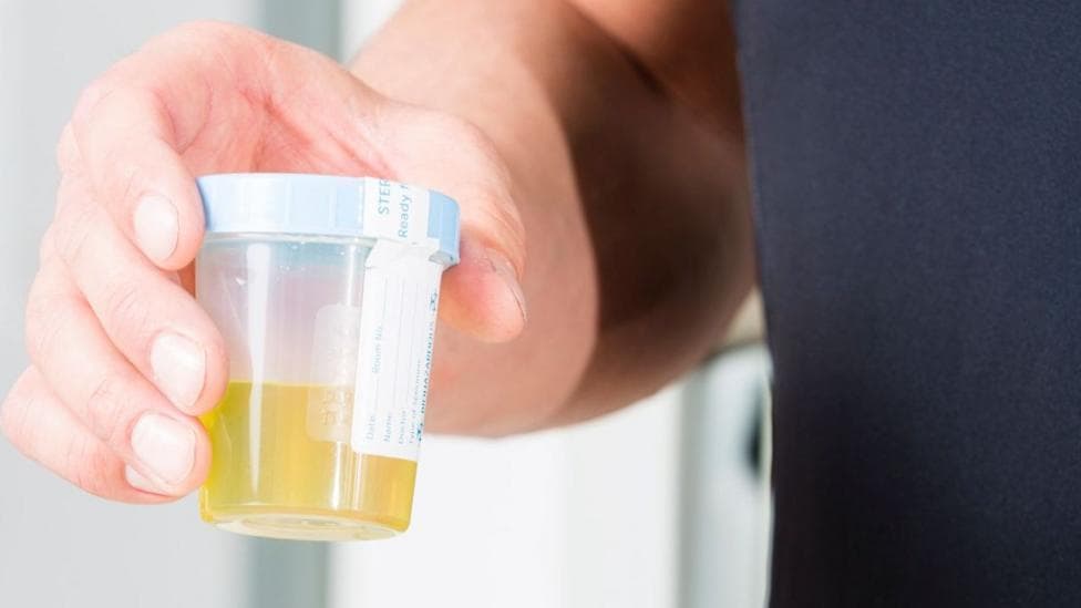A man holds a urine sample in a pot