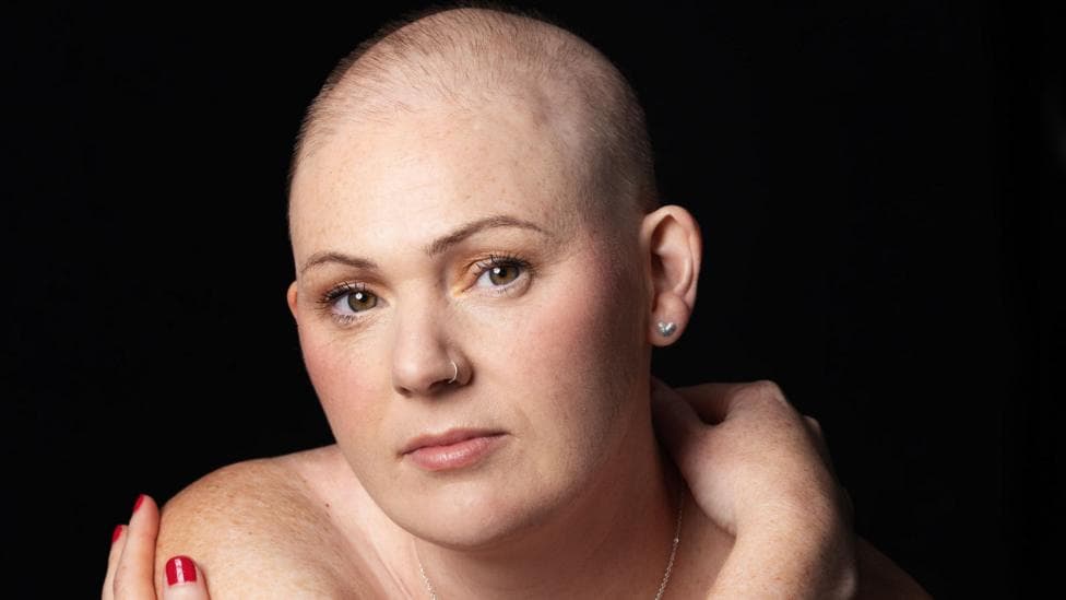 Rhiannon looking into the camera with a thoughtful expression on her face. She is almost completely bald. She has a silver hoop nose ring and silver heart stud earrings.