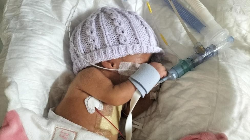 A premature baby is lying in a cot attached to breathing tubes and other equipment with a lilac hand-knitted hat on.
