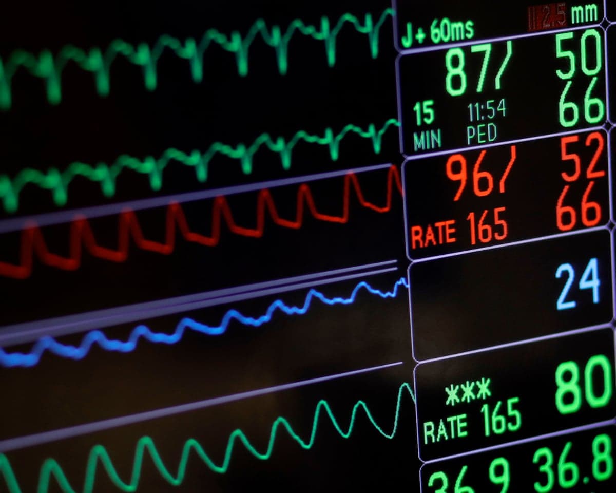 Close-up of a hospital monitor screen showing heart rate and vital sign waveforms