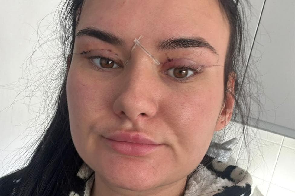 A close-up of a Nikita's face showing post-surgical healing, with adhesive strips and sutures around both eyes and across the bridge of the nose. The eyelids appear swollen and red, indicating recent medical treatment.