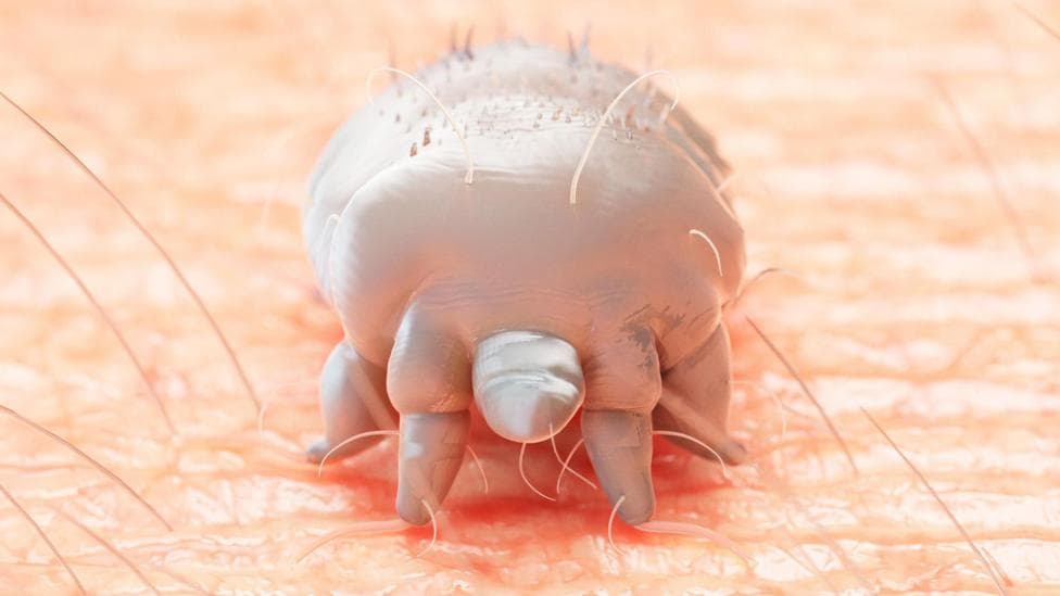 An artist's impression of a mite on the skin.