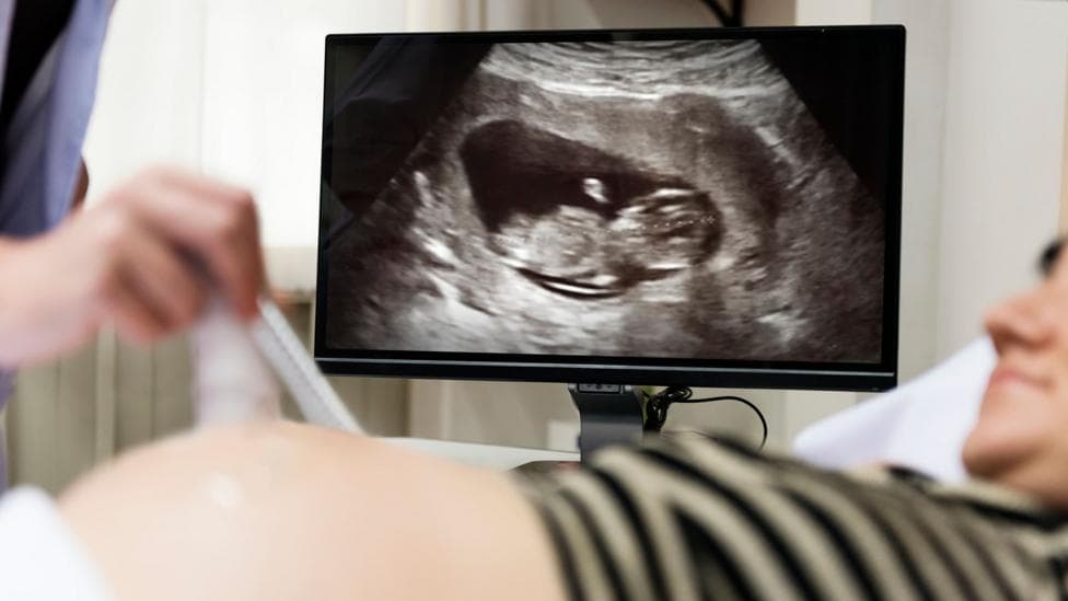 A generic image of a woman having an ultrasound scan with her baby visible on a screen behind her