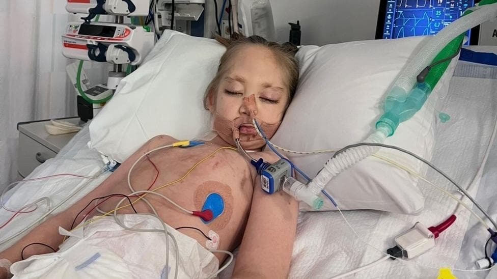 Willow lies on a hospital bed with tubes attached to her body
