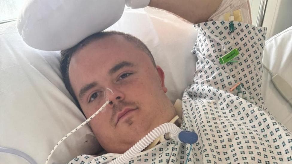 A man in a hospital gown lying in bed. He has his left hand on his head in a white mit. He has a tube in his throat and one in his nose too.
