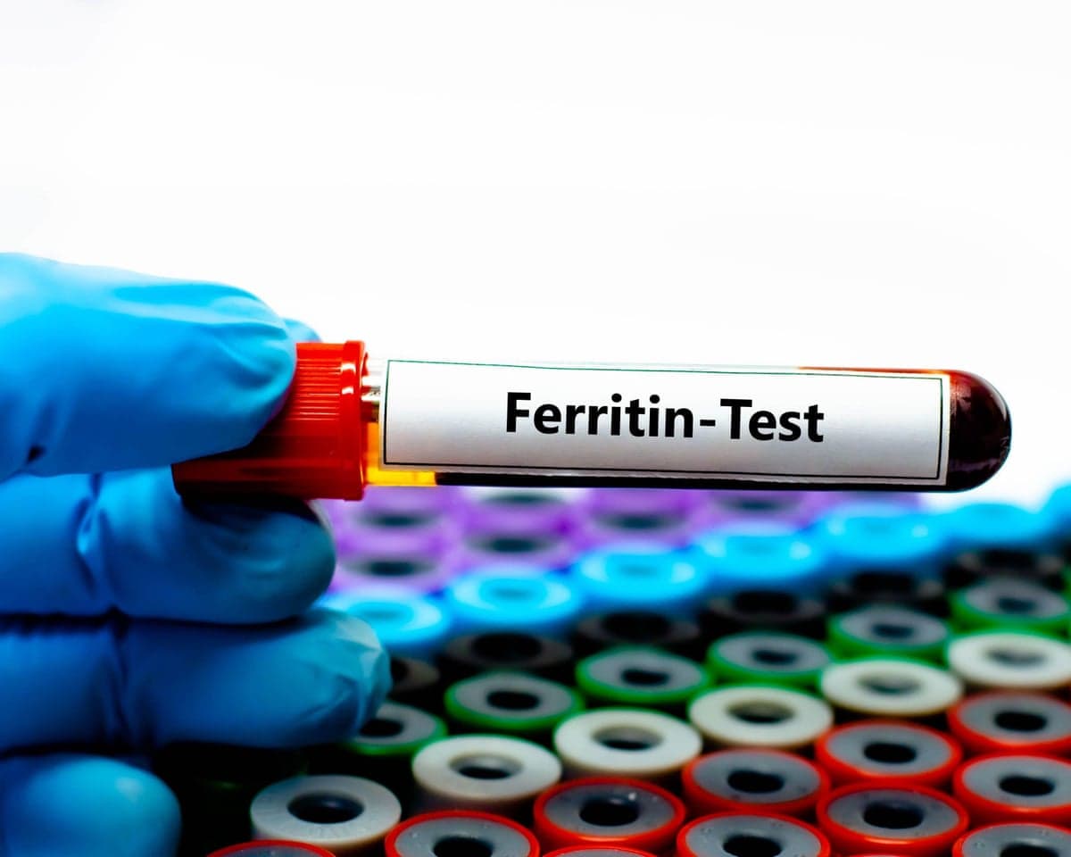 Part of blue gloved hand holding a test tube with 'Ferritin-Test' written on the label